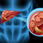 Liver Problems : ఇవి తింటే ఇక మీ లివర్‌ పని అంతే