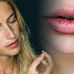 Skin care : పెదాల పగుళ్లను నివారించే ఉప్పు