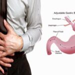 Gastric: ఇలా చేస్తే గ్యాస్ట్రిక్‌ సమస్య నుంచి బయటపడొచ్చు