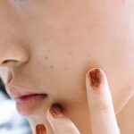 Remedy For Black Heads : ఇలా చేస్తే బ్లాక్‌హెడ్స్ మాయం