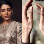 Samantha: షూటింగ్‌లో ప్రమాదం.. సమంతకు గాయాలు.. ఆందోళనలో ఫ్యాన్స్