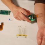 Smart Bandage : కొత్తగా స్మార్ట్ బ్యాండేజ్.. ప్రత్యేకంగా వారికోసమే..