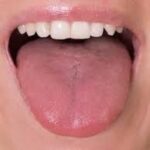 Tongue : నాలుకపై మచ్చ ఉంటే..