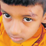 Hospital: దెబ్బ తగిలితే కుట్లు వేయకుండా ఫెవిక్విక్‌తో అతికించేశారు.. ప్రైవేట్ ఆసుపత్రి నిర్వాకం..