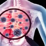 Tuberculosis- TB : టీబీ కోరల్లో ప్రపంచం