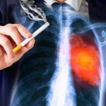 Lung Cancer : స్మోకింగ్ చేయకున్నా లంగ్ కేన్సర్‌