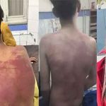 Employer beats Dalit | వేతనం అడిగినందుకు దళిత యువకుడి నోట్లో చెప్పులు పెట్టి..