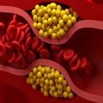 Vaccine For Lowering ldl : టీకాతో చెడు కొలెస్ట్రాల్‌కు అడ్డుకట్ట!