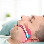 Sleep Apnea : స్లీప్ ఆప్నియా.. ఈ ఆహారాలతో గుడ్ బై చెప్పండి!