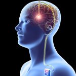 Brain Pacemaker for Depression: డిప్రెషన్‌ను తగ్గించే బ్రెయిన్ పేస్ మేకర్..