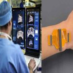 Mit-Ultrasound Sticker : ఆర్గాన్ల గుట్టు విప్పే స్టిక్కర్..!