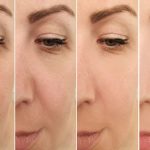 Beauty Problems : బీకేర్ ఫుల్ అమ్మాయిలు.. లేదంటే మీ ఫేస్..!