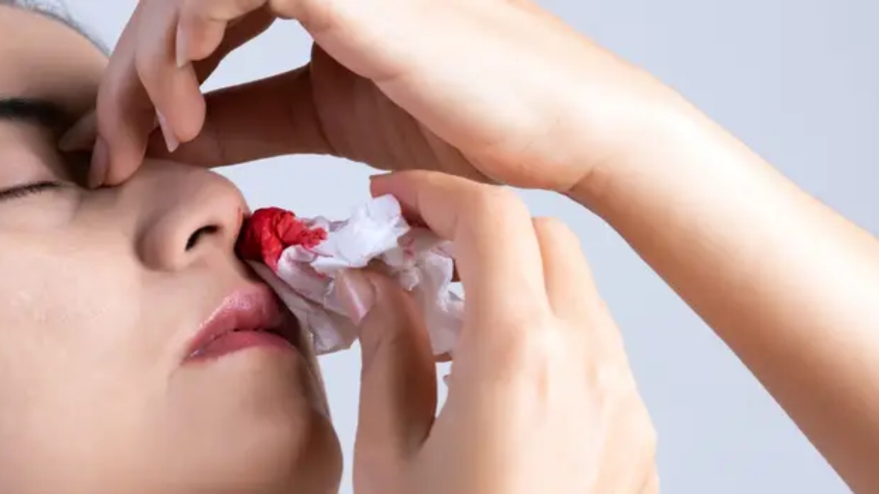 Nose Bleeding 