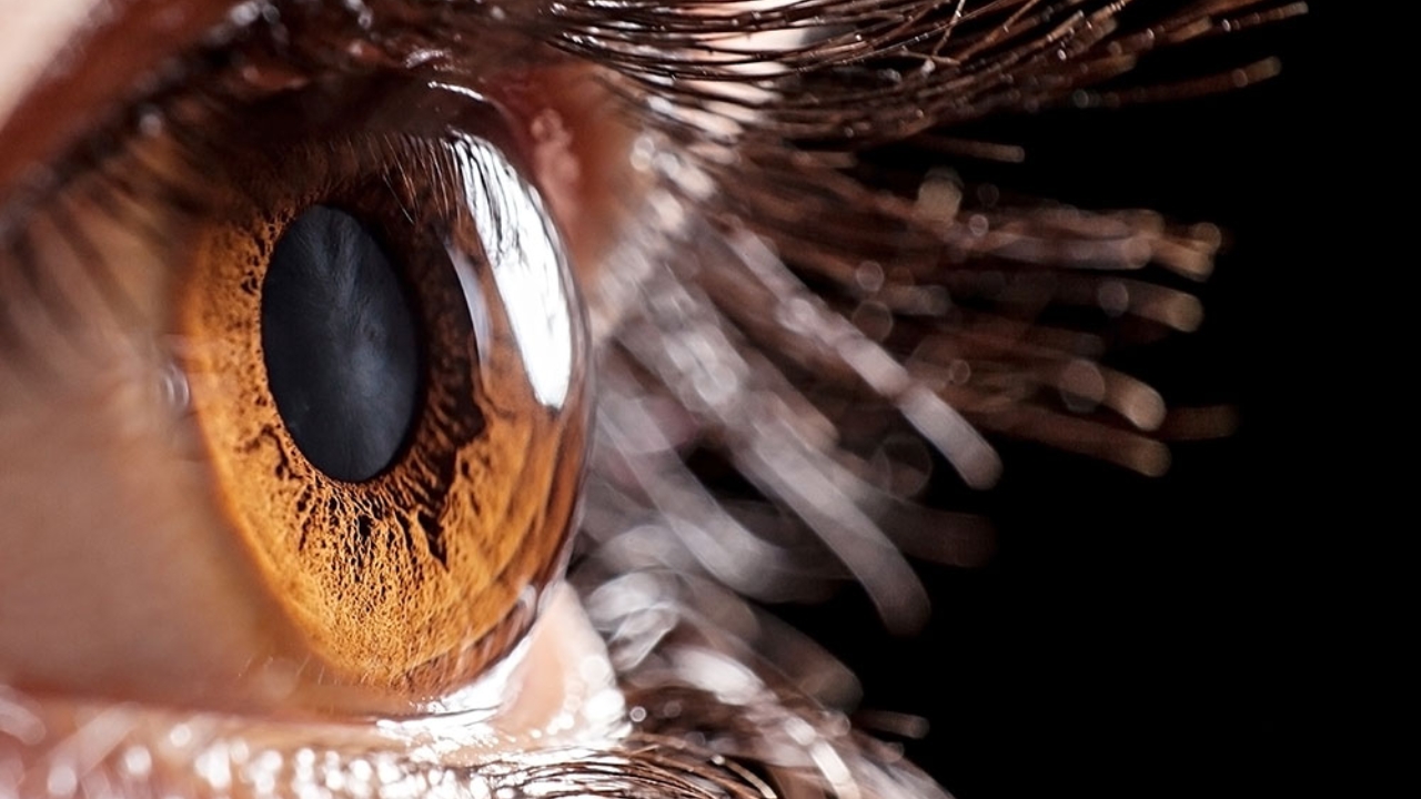 Retina Problems