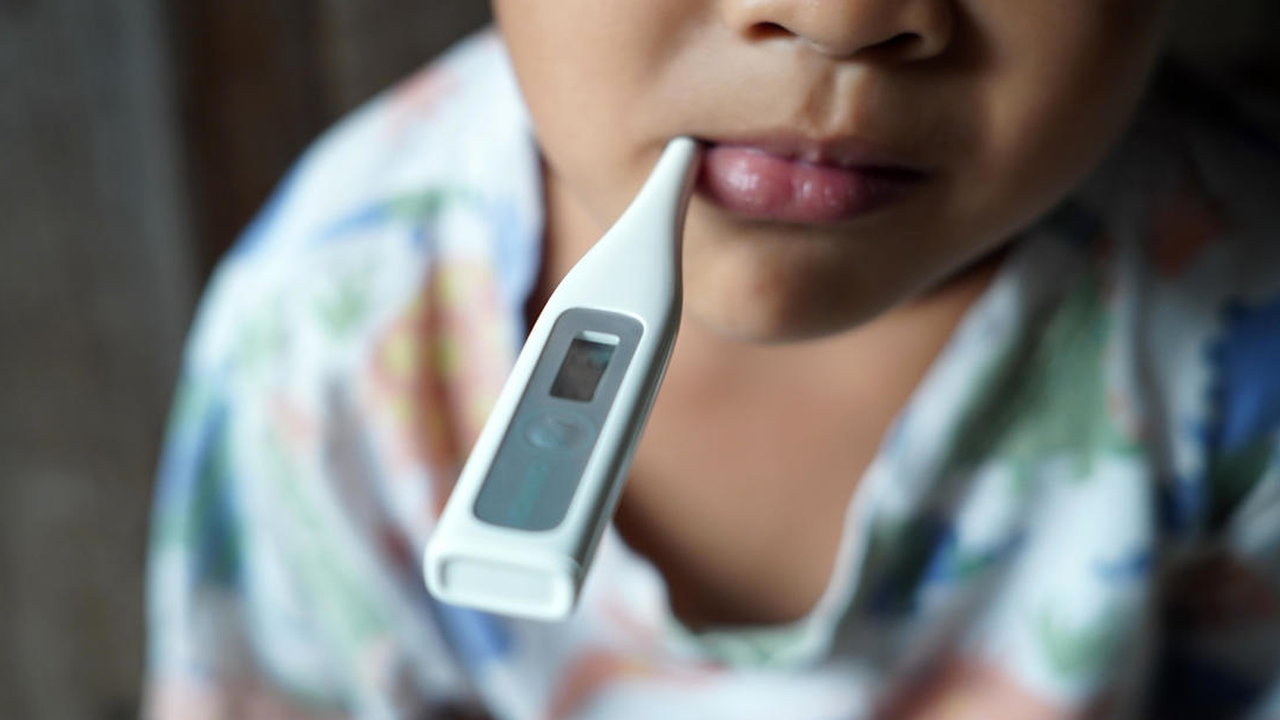 scarlet fever in hyderabad 
