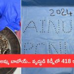 418 Stones in Kidney: నాలుగు రాళ్లు వెనకేసుకోమంటే.. మనోడు ఏకంగా కిడ్నీలో 400కి పైగా వెనకేసుకున్నాడట!