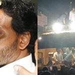Stone Attack on CM Jagan: సీఎం జగన్ పైకి రాయి.. ఎడమ కంటికి గాయం