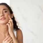 Health Tips: మొటిమలకు చెక్ పెట్టండిలా..