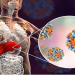 Hepatitis Viruses in India: విజృంభిస్తున్న హెపటైటిస్.. రోజులు 3,500 మరణాలు.. రెండో స్థానంలో భారత్!