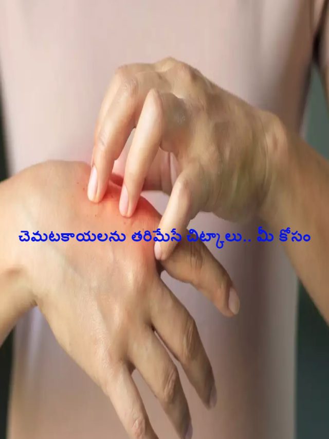 Tips for Sweat Blisters : చెమటకాయలను తరిమేసే చిట్కాలు.. మీ కోసం