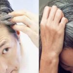 Cause of White Hair: చిన్న వయసులోనే  తెల్లజుట్టు రావడానికి కారణాలేంటో తెలుసా..?
