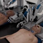 Startup claims head transplant system: హెడ్ ట్రాన్స్‌ప్లాంట్.. తొలుత రోబోలతో..
