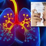 Stages of Asthma: ఆస్తమాలో 4 దశలు.. ఇందులో ఏది అత్యంత ప్రాణాంతకమో తెలుసా..?