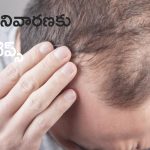 Hair Loss Prevention: బట్టతల రాకుండా ఉండాలంటే.. ఈ టిప్స్ ట్రై చేయండి