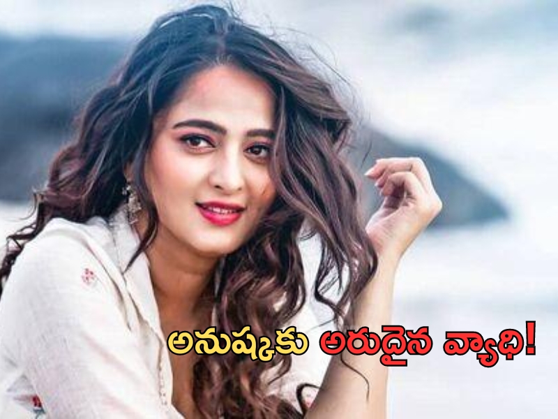 Anushka Laughing Disorder: దేవసేన అనుష్కకు వింత వ్యాధి..లాఫింగ్ డిజార్డర్ ఏంటో తెలుసా..?