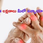 Calcium Deficiency: ఈ లక్షణాలు మీలో ఉన్నాయా ? అయితే క్యాల్షియం తగ్గినట్టే