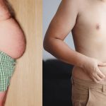 Belly Fat in Men: పురుషులకే పొట్ట ఎందుకు ఎక్కువగా పెరుగుతుందో తెలుసా?