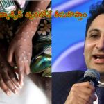 Serum Institute Mpox Vaccine: ‘త్వరలోనే మంకీపాక్స్ వ్యాక్సిన్ తీసుకొస్తాం’.. సీరమ్ ఇన్స్‌టిట్యూట్
