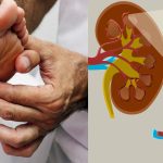 Kidney Cancer Symptoms: ఈ లక్షణాలు మీలో ఉన్నాయా ? జాగ్రత్త !