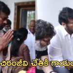 Megastar Chiranjeevi : చిరంజీవి చేతికి గాయం.. ‘విశ్వంభర ‘ షూటింగ్ కు బ్రేక్..?