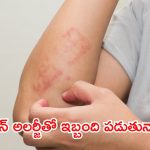 Skin Allergy : స్కిన్ అలర్జీతో ఇబ్బంది పడుతున్నారా ? వీటిని వాడండి