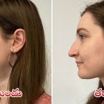 Double Chin:డబుల్ చిన్‌తో ఇబ్బంది పడుతున్నారా ? ఈ చిట్కాలతో సమస్య పరార్ !