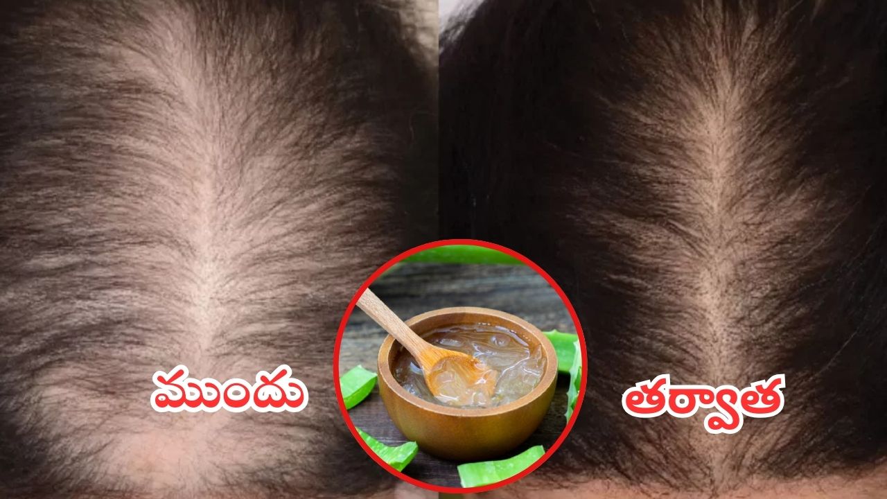 Hair Fall: జుట్టు రాలుతోందా ? వీటిని వాడితే.. అస్సలు రాలదు