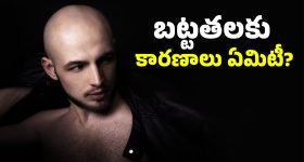 Hair Care: మీరు చేసే ఈ తప్పులు మీకు బట్టతల రావడానికి కారణంగా మారుతాయి