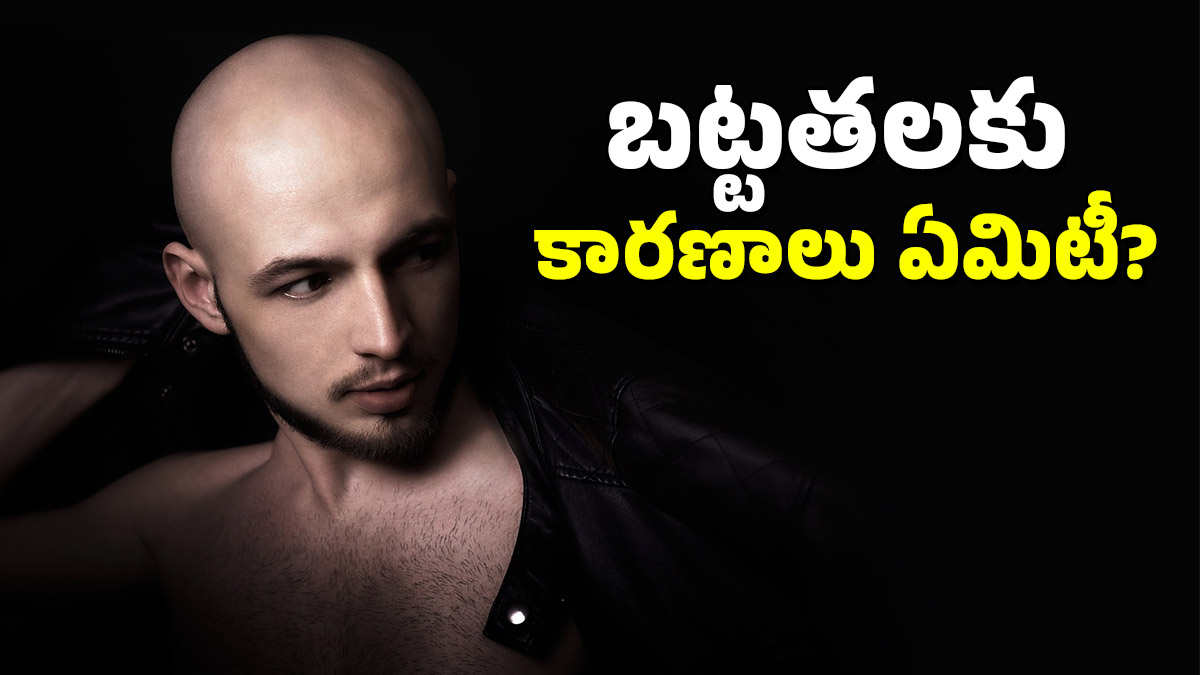 Hair Care: మీరు చేసే ఈ తప్పులు మీకు బట్టతల రావడానికి కారణంగా మారుతాయి