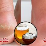 Cracked Heels: కాళ్ల పగుళ్లు వెంటనే తగ్గాలంటే.. కర్పూరంలో ఇవి కలిపి వాడండి