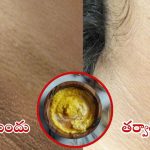Dark Neck: మెడ చుట్టూ చర్మం నల్లగా మారిందా ? ఒక్క సారి ఈ టిప్స్ ట్రై చేయండి