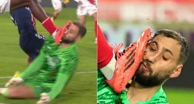 Gianluigi Donnarumma Injury: ఇదేం ఆట... ముఖంపై బూటుతో తన్ని మరీ ?