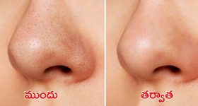 Miniaster Anam-Botsa: దిగజారుడు మాటలొద్దు.. బొత్సపై మంత్రి ఆనం ఫైర్