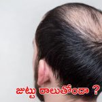 Tips For Hair: విపరీతంగా జుట్టు రాలుతోందా ? ఇలా చేస్తే.. ప్రాబ్లమ్ సాల్వ్