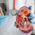 Kidney Health: ఈ 3 అలవాట్లు కిడ్నీలను పాడు చేస్తాయి, మీరూ ఇలానే చేస్తున్నారా ?