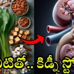 Kidney Stones: మీరూ ఈ కూరగాయలు తింటున్నారా ? అయితే కిడ్నీ స్టోన్స్ గ్యారంటీ