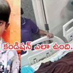 Sri Tej Health Update : శ్రీ తేజ్ పూర్తిగా కోలుకున్నాడా? డాక్టర్లు ఏం అన్నారంటే..?
