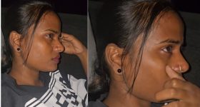 Kidney Stones: కిడ్నీలో రాళ్లు ఏర్పడకుండా ఉండాలంటే.. ఏం చేయాలి ?