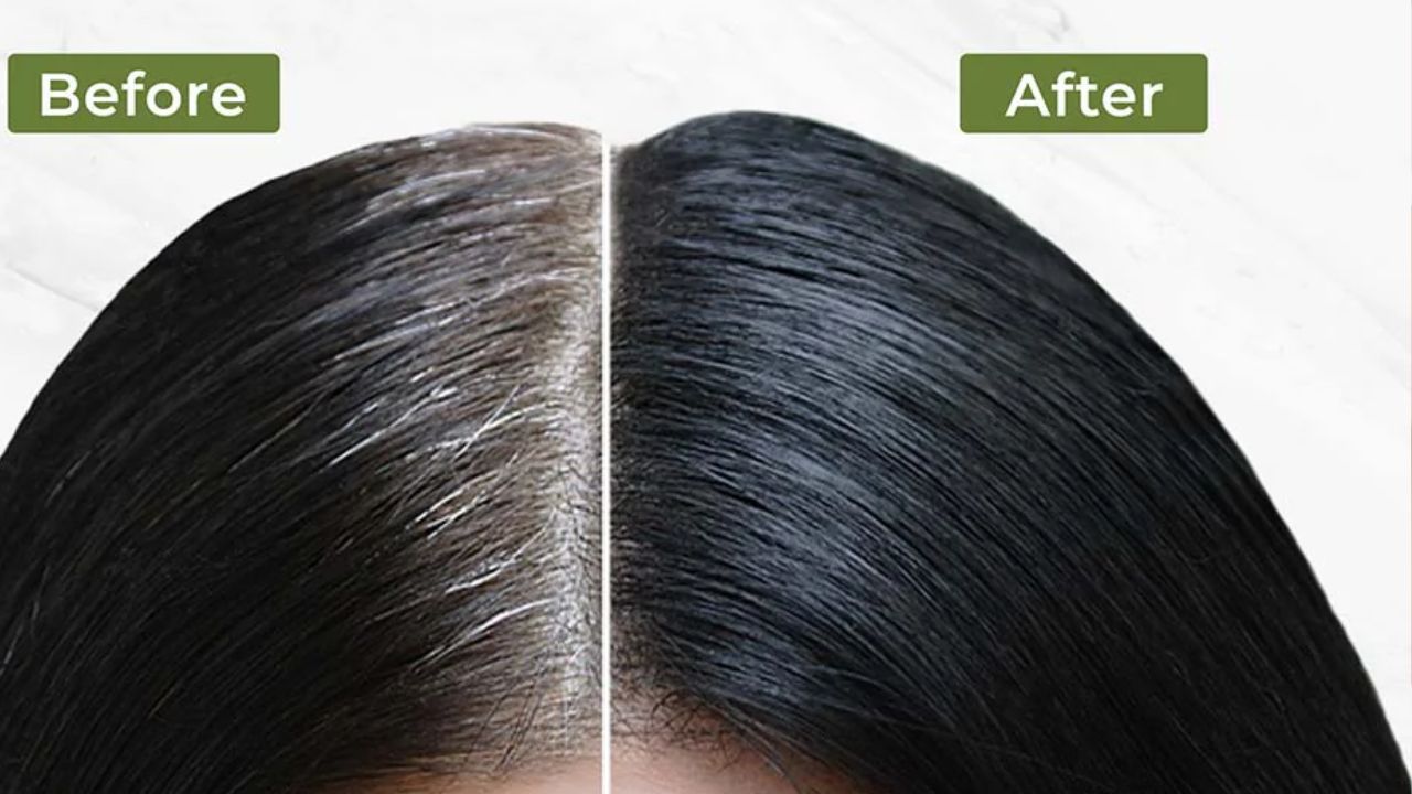 White Hair Remedies: చిన్న వయస్సులోనే తెల్ల జుట్టు సమస్యా ? ఇలా చేస్తే.. సమస్య దూరం