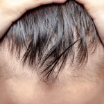 Hair Fall: విపరీతంగా జుట్టు రాలుతోందా ? ఈ టిప్స్ మీ కోసమే !